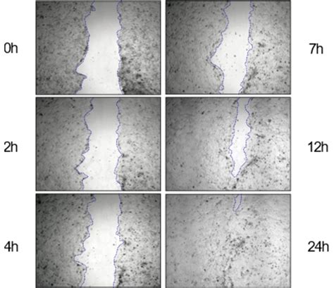 Wound healing - Non-artificial human in vitro skin tests | Alcyomics