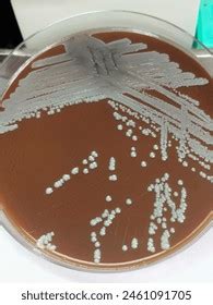 Colony Morphology Staphylococcus Epidermidis On Chocolate Stock Photo ...