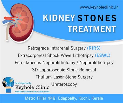 Kidney Stones Treatment in Kerala, Kochi - Keyhole Clinic