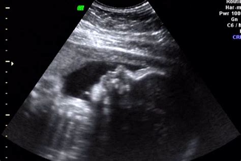 30 weeks ultrasound profile | Flickr - Photo Sharing!