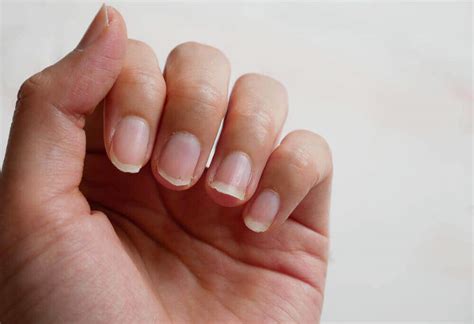 What the Lunula of Your Nails Says about Your Health