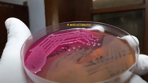 Aeromonas hydrophila colony morphology on MacConkey agar Archives ...