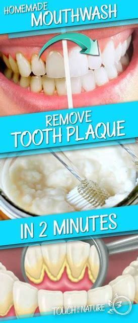 This Homemade Mouthwash Removes Tooth Plaque In 2 Minutes - HEALTH PLUS