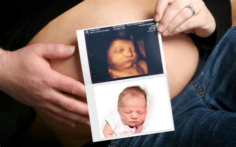 4D Ultrasound System Benefits