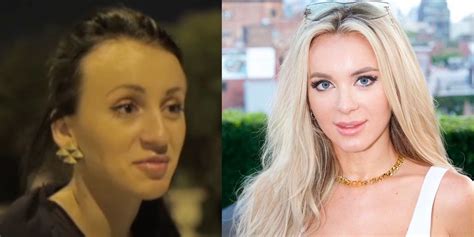 How 90 Day Fiancé's Yara's Face Changed After Plastic Surgery Makeover