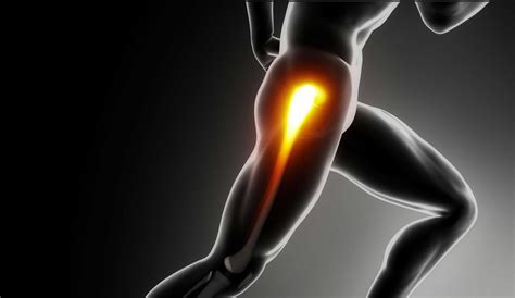 Gluteal Tendinopathy | Lara Physiotherapy