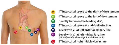 12 Lead Ecg Placement on a Female