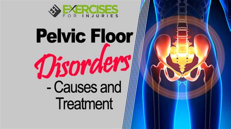 Pelvic Floor Disorders