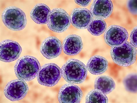 New prognostic index for Burkitt lymphoma - BJH