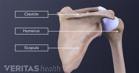 The 3 Types of Shoulder Fractures