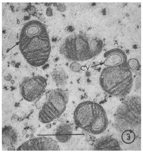 Mitochondria Electron Micrograph Labelled