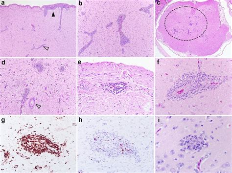 Histology of representative lesions in the nervous tissue of Muscovy ...