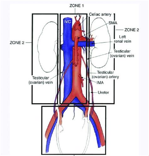 Retroperitoneal Muscles