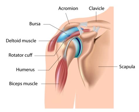 Rotator Cuff Bursitis - Upswing Health | Upswing Health