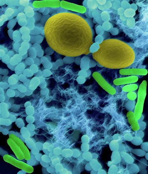 Bacteria (bacilli And Cocci) And Yeast Photograph by Dennis Kunkel ...