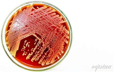 Staph aureus: gram positive bacteria. staphylococcus or streptococcus ...