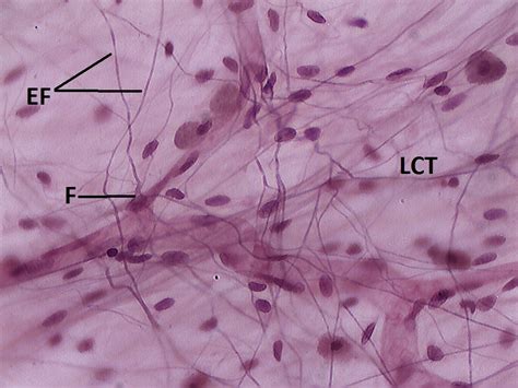 Loose Areolar Connective Tissue, 40X | Histology