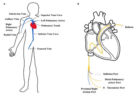 | Cardiovascular system and catheterization procedure. (A) Diagram of ...