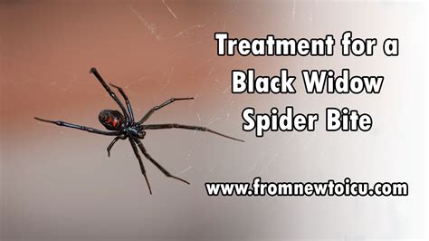 Black Widow Spider Bite Symptoms Humans - Widow Spider Bite Symptoms ...