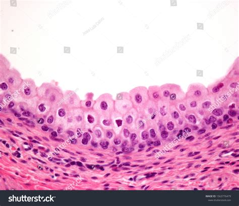 123 Transitional Epithelium Images, Stock Photos & Vectors | Shutterstock