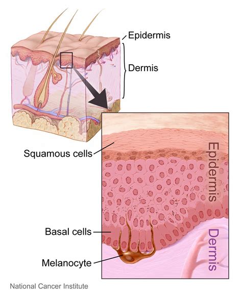 What Are The Beginning Signs of Skin Cancer? | SERO