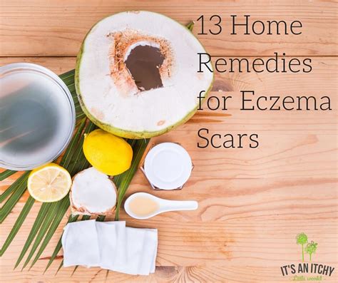 13 Home Remedies for Eczema Scars