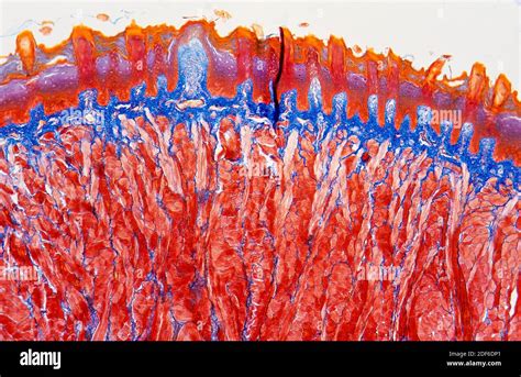 Tongue cross section with taste buds or gustatory cells. Optical ...