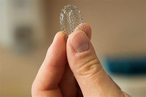 Why do leg stents fail so fast? UNMC has a $3.5 million grant to find ...