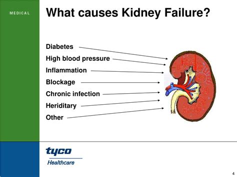 PPT - Dialysis Access PowerPoint Presentation, free download - ID:256384