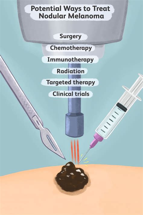 Melanoma - AydenSantino