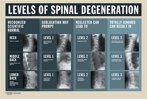 Levels of Spinal Degeneration - MIND TWEAK