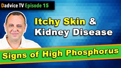 Itchy Skin & Chronic Kidney Disease - A sign of low kidney function ...