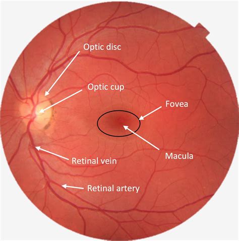 Eye examination and fundoscopy (ophthalmoscopy) station - OSCE