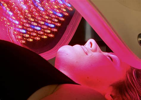 Red Light Therapy for Rosacea: Things You Need To Know Now