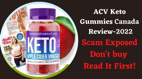 ACV Keto Gummies Canada (Apple Cider Vinegar Scam Reviews) Via Apple ...