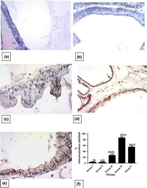 Active Caspase 3 Antibody (PA1-26426)