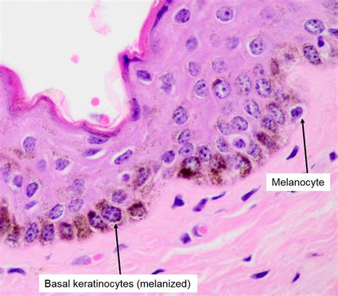 Melanocyte Histology