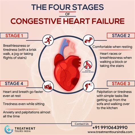 Stages of Congestive Heart Failure in 2020 | Congestive heart failure ...