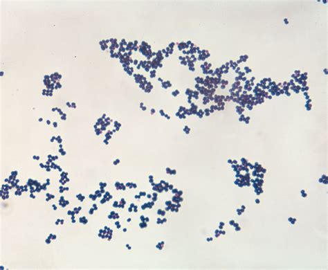 Staphylococcus aureus | Characteristics, Infections, Transmission ...