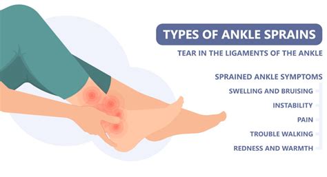 How to Heal a Ankle Injury using Sprain Ankle Treatment