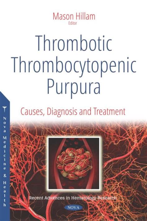 Thrombotic Thrombocytopenic Purpura: Causes, Diagnosis and Treatment ...