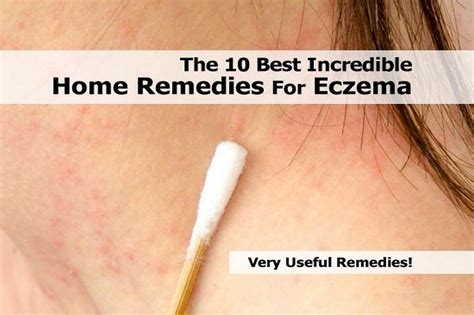 The 10 Best Incredible Home Remedies For Eczema