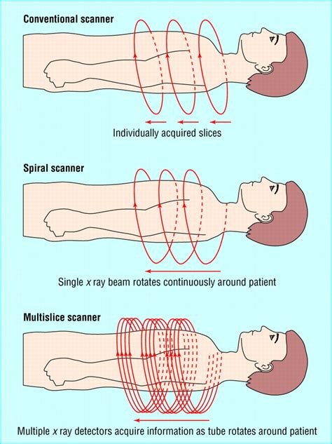 Computed tomography in clinical practice | The BMJ