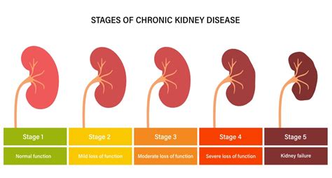 5 Causes and Risk Factors for Chronic Kidney Disease