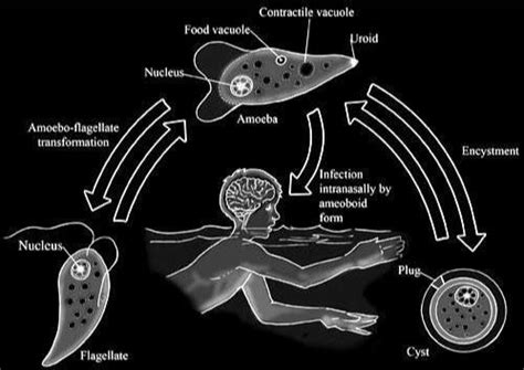 Naegleria Fowleri Virus | What are the Symptoms & Treatment? - RAZ TV