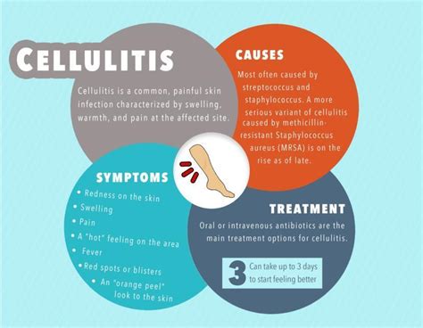 Cellulitis Infection