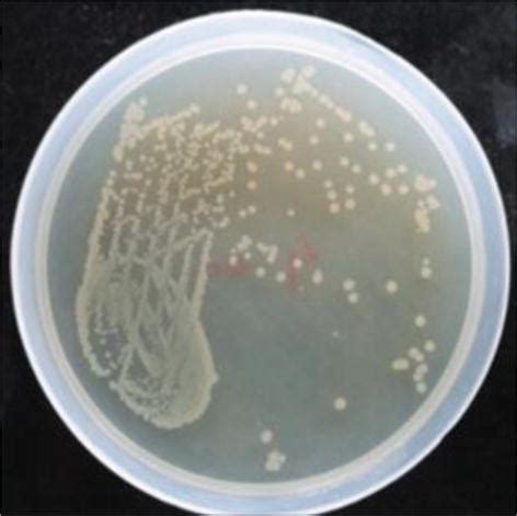 E Coli Plate Morphology