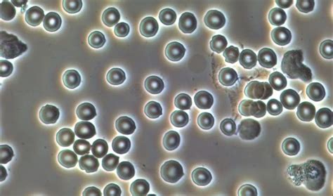 What Is Phase Contrast Microscopy?