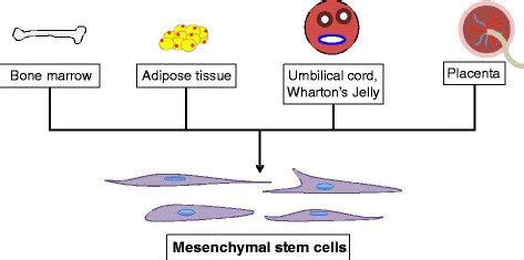 Sources of mesenchymal stem cells. Mesenchymal stem cells can be ...