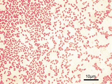 Pseudomonas aeruginosa